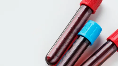 Pendant le Festival des Marionettes, le Cegidd propose des...